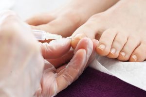 Everything You Need To Know About Ingrown Toenails And How To Treat Them