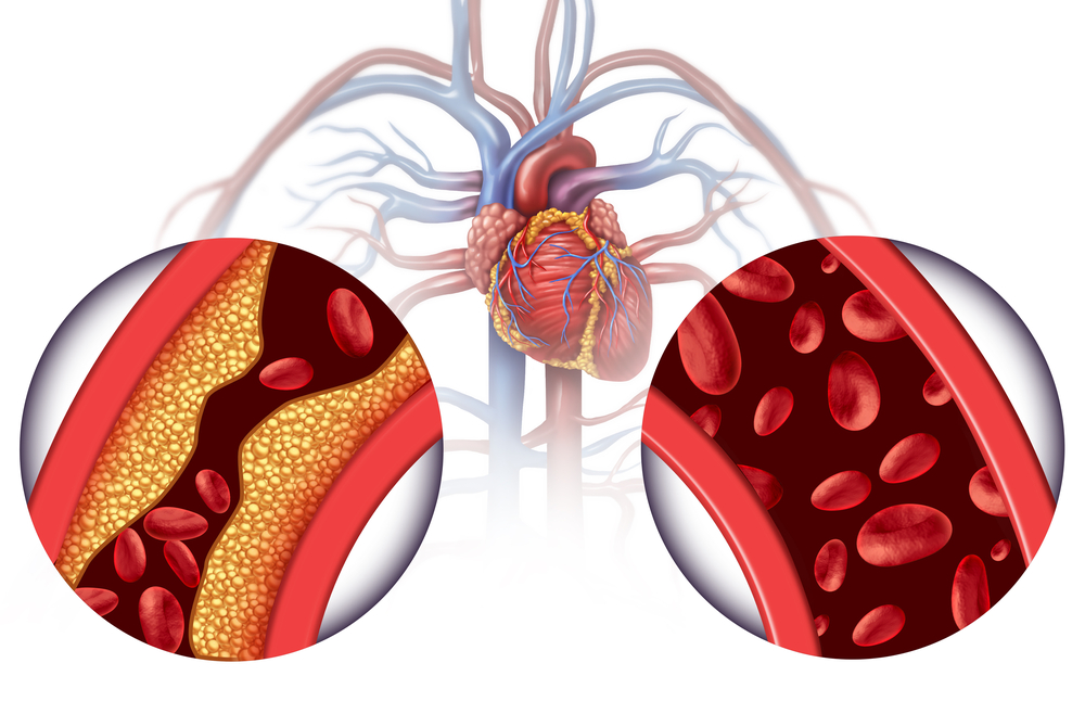 Detox And Renew Discover Local Chelation Therapy Centers For Holistic Healing